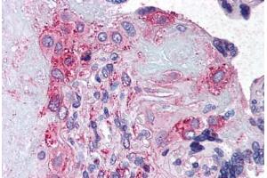 Anti-ADAMTS5 antibody  ABIN1048294 IHC staining of human placenta. (ADAMTS5 Antikörper  (Internal Region))