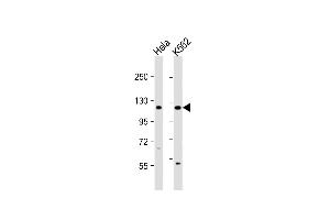 Western Blotting (WB) image for anti-DEAD/H (Asp-Glu-Ala-Asp/His) Box Polypeptide 11 (DDX11) (AA 819-847), (C-Term) antibody (ABIN655503)