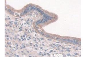 Detection of CTTN in Mouse Uterus Tissue using Polyclonal Antibody to Cortactin (CTTN) (Cortactin Antikörper  (AA 1-509))