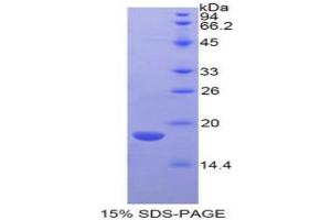 SDS-PAGE analysis of Mouse LYAR Protein. (LYAR Protein)
