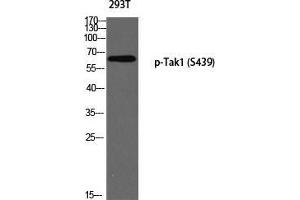 Western Blot (WB) analysis of 293T using p-Tak1 (S439) antibody. (TR4 Antikörper  (pSer439))