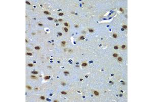 Immunohistochemistry of paraffin-embedded rat brain using P antibody (ABIN6132463, ABIN6145262, ABIN6145264 and ABIN6216484) at dilution of 1:100 (40x lens). (PAX7 Antikörper  (AA 289-518))