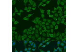 Immunofluorescence analysis of U2OS cells using PLA2G4C Polyclonal Antibody at dilution of 1:100. (PLA2G4C Antikörper)