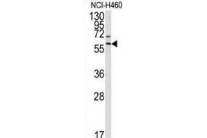Western Blotting (WB) image for anti-Matrix Metallopeptidase 17 (Membrane-inserted) (MMP17) antibody (ABIN3002547) (MMP17 Antikörper)