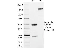 SDS-PAGE Analysis Purified IgM Mouse Monoclonal Antibody (IM373). (IGHM Antikörper)