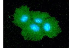 ICC/IF analysis of SAR1B in Hep3B cells line, stained with DAPI (Blue) for nucleus staining and monoclonal anti-human SAR1B antibody (1:100) with goat anti-mouse IgG-Alexa fluor 488 conjugate (Green). (SAR1B Antikörper  (AA 1-198))
