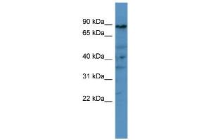 WB Suggested Anti-PDE8A Antibody Titration: 0. (PDE8A Antikörper  (C-Term))
