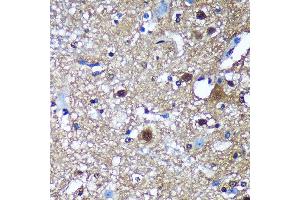 Immunohistochemistry (IHC) image for anti-Translin (TSN) (AA 50-150) antibody (ABIN7270923)