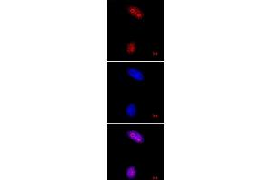 Histone H3K27me3 pAb tested by immunofluorescence.
