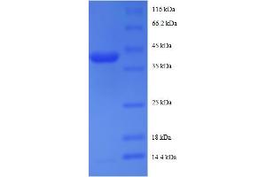 SDS-PAGE (SDS) image for Ribosomal Protein S19 Binding Protein 1 (RPS19BP1) (AA 1-145), (full length) protein (GST tag) (ABIN5712077)