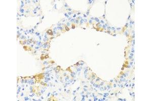 Immunohistochemistry of paraffin-embedded Mouse bronchus using MAPRE3 Polyclonal Antibody at dilution of 1:100 (40x lens). (MAPRE3 Antikörper)