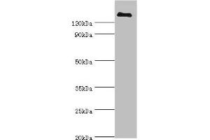 Western blot All lanes: CFH antibody at 3 μg/mL + human serum Secondary Goat polyclonal to rabbit IgG at 1/10000 dilution Predicted band size: 140, 52 kDa Observed band size: 140 kDa