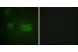 Immunofluorescence analysis of HuvEc cells, using MRLC2 (Ab-18) Antibody. (MYL12B Antikörper  (AA 3-52))