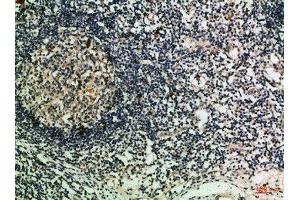 Immunohistochemical analysis of paraffin-embedded Human-lymph, antibody was diluted at 1:100