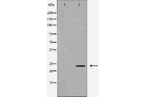 Western blot analysis of A431 cell lysate, using IL24 Antibody. (IL-24 Antikörper  (Internal Region))
