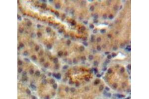 Used in DAB staining on fromalin fixed paraffin-embedded Kidney tissue (CST5 Antikörper  (AA 21-142))