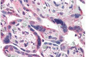 Immunohistochemistry (Paraffin-embedded Sections) (IHC (p)) image for anti-Nuclear Factor of kappa Light Polypeptide Gene Enhancer in B-Cells 1 (NFKB1) (AA 1-15) antibody (ABIN337304)