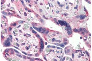 Human Placenta (formalin-fixed, paraffin-embedded) stained with NFKB1 antibody ABIN337304 at 10 ug/ml followed by biotinylated secondary antibody, alkaline phosphatase-streptavidin and chromogen. (NFKB1 Antikörper  (AA 1-15))