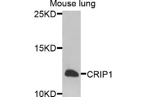 Western blot analysis of extracts of mouse lung, using CRIP1 antibody. (CRIP1 Antikörper)