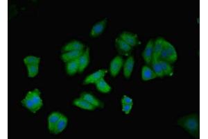 Immunofluorescent analysis of HepG2 cells using ABIN7144130 at dilution of 1:100 and Alexa Fluor 488-congugated AffiniPure Goat Anti-Rabbit IgG(H+L) (AGT Antikörper  (AA 35-285))