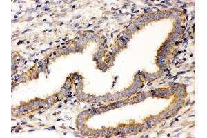 Immunohistochemistry (IHC) image for anti-Wingless-Type MMTV Integration Site Family, Member 7A (WNT7A) (AA 226-256), (C-Term) antibody (ABIN3042348)