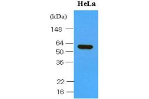 Western blot analysis: Cell lysates of Hela (30ug) were resolved by SDS-PAGE, transferred to NC membrane and probed with anti-human HSP60 (1:1000).