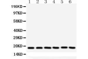 Western blot analysis of SOD1 using anti- SOD1 antibody . (SOD1 Antikörper  (C-Term))
