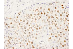 anti-Splicing Factor, Arginine/serine-Rich 14 (SFRS14) (AA 725-775) antibody