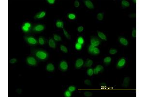 Immunofluorescence of monoclonal antibody to ZNF21 on HeLa cell. (ZNF182 Antikörper  (AA 81-190))