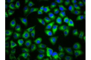 Immunofluorescence staining of Hela cells with ABIN7159233 at 1:133, counter-stained with DAPI. (MC1 Receptor Antikörper  (AA 1-37))