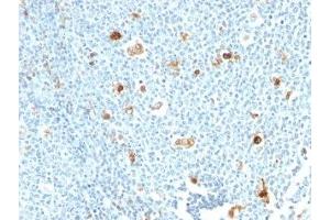 Formalin-fixed, paraffin-embedded human tonsil stained with Calprotectin antibody (CPT/1028)