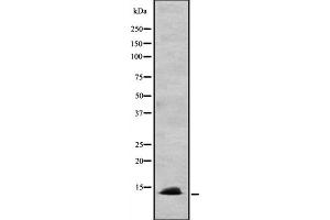 Western blot analysis of CCL24 expression in HEK293 cells ,The lane on the left is treated with the antigen-specific peptide. (CCL24 Antikörper  (C-Term))