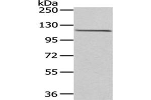 Gel: 6 % SDS-PAGE,Lysate: 40 μg,Primary antibody: ABIN7193040(WDR36 Antibody) at dilution 1/200 dilution,Secondary antibody: Goat anti rabbit IgG at 1/8000 dilution,Exposure time: 1 minute (WDR36 Antikörper)