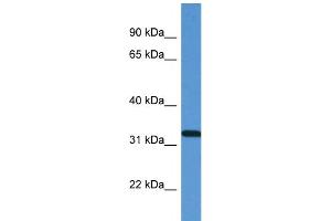 WB Suggested Anti-ZAP70 Antibody Titration: 1. (ZAP70 Antikörper  (N-Term))