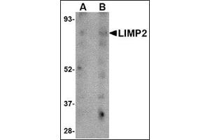 Western blot analysis of LIMP2 in human skeletal muscle tissue lysate with this product at (A) 1 and (B) 2 μg/ml. (SCARB2 Antikörper  (C-Term))