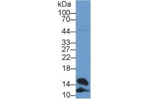Detection of FABP4 in Rat Heart lysate using Polyclonal Antibody to Fatty Acid Binding Protein 4 (FABP4)