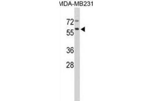 Western Blotting (WB) image for anti-Cathepsin F (CTSF) antibody (ABIN3002689)