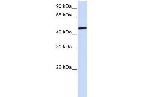 WB Suggested Anti-UMPS Antibody Titration:  0. (UMPS Antikörper  (C-Term))