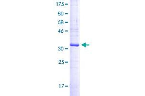 CD37 Protein (AA 112-211) (GST tag)