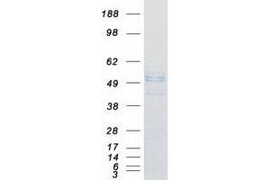 Western Blotting (WB) image for Fukutin Related Protein (FKRP) (Transcript Variant 1) protein (Myc-DYKDDDDK Tag) (ABIN2721451)