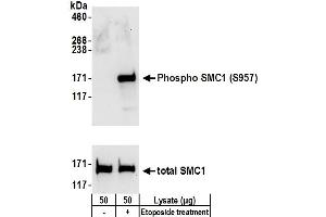 Western Blotting (WB) image for anti-Structural Maintenance of Chromosomes 1A (SMC1A) (pSer957) antibody (ABIN7453448)