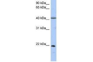 GUK1 antibody used at 1 ug/ml to detect target protein.