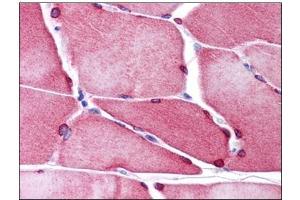 Human Skeletal Muscle: Formalin-Fixed, Paraffin-Embedded (FFPE) (TMEM38A Antikörper  (C-Term))