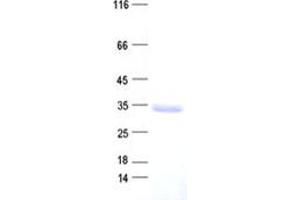 Western Blotting (WB) image for F-Box Protein 25 (FBXO25) protein (His tag) (ABIN2720949)