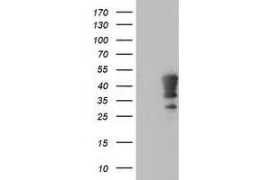 Western Blotting (WB) image for anti-Homeobox C11 (HOXC11) (AA 1-304) antibody (ABIN1490736) (HOXC11 Antikörper  (AA 1-304))