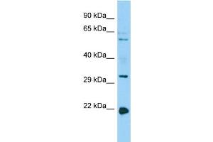 Host: Rabbit Target Name: CORO1B Sample Type: HepG2 Whole Cell lysates Antibody Dilution: 1. (CORO1B Antikörper  (C-Term))