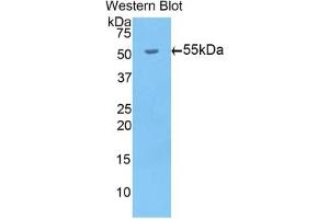 Detection of Recombinant bACE1, Mouse using Polyclonal Antibody to Beta-Site APP Cleaving Enzyme 1 (bACE1) (BACE1 Antikörper  (AA 190-430))