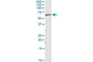 Immunoprecipitation of AKT1 transfected lysate using anti-AKT1 monoclonal antibody and Protein A Magnetic Bead , and immunoblotted with AKT1 MaxPab rabbit polyclonal antibody. (AKT1 Antikörper  (AA 381-480))