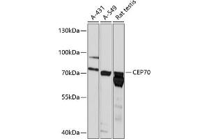 Western blot analysis of extracts of various cell lines, using CEP70 antibody (ABIN6129670, ABIN6138429, ABIN6138430 and ABIN6218042) at 1:3000 dilution. (CEP70 Antikörper  (AA 1-280))