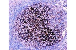 IHC-P: CD82 antibody testing of human tonsil tissue (CD82 Antikörper  (AA 98-267))